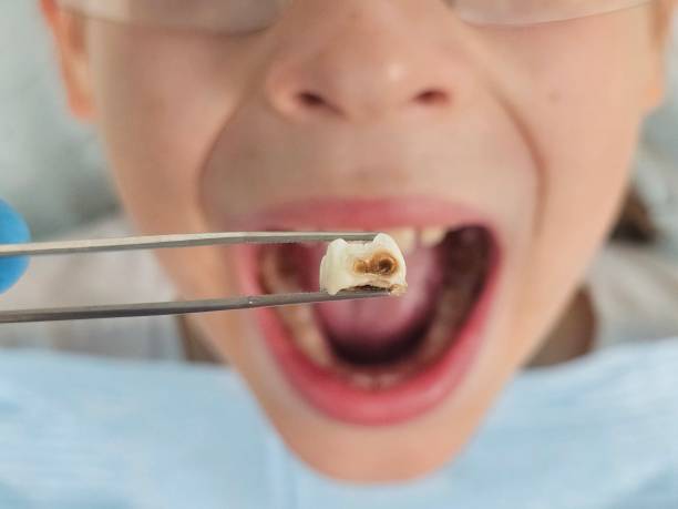 Best Walk-In Emergency Dental Services in Chauvin, LA